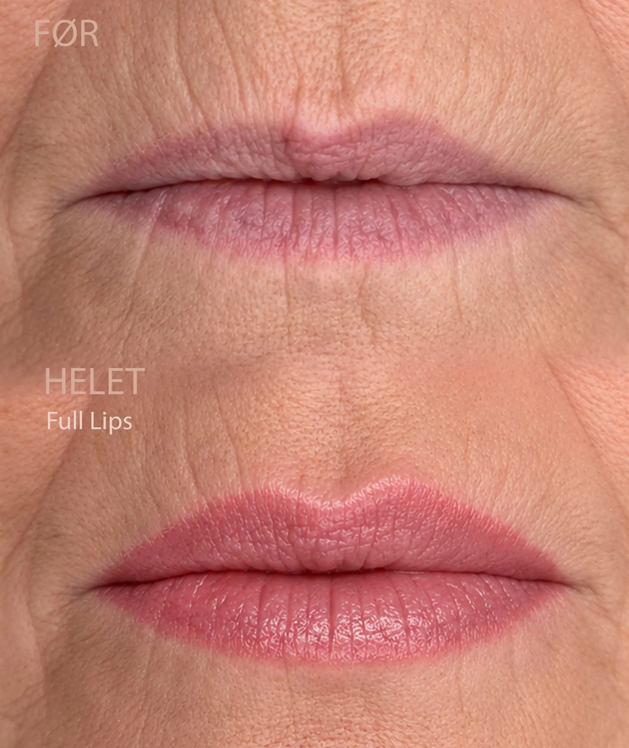 Full Lips. Full Lips med defineret læbekant og dækkende farve.